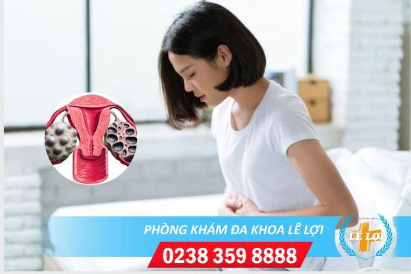 Địa Chỉ Hỗ Trợ Chữa Đa Nang Buồng Trứng An Toàn – Hiệu Quả ở Tp.Vinh