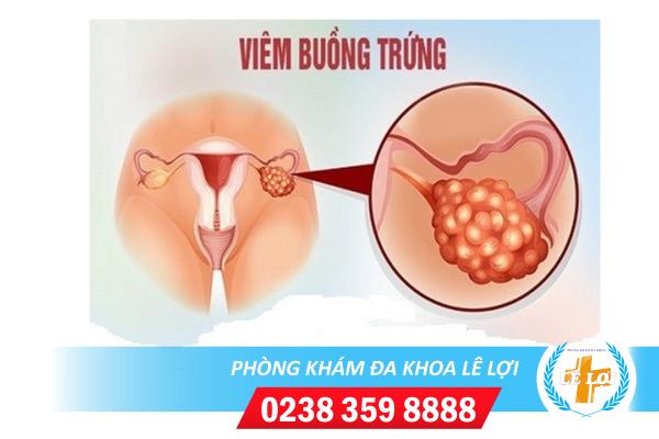 benh-viem-buong-trung-nguy-hiem-khong