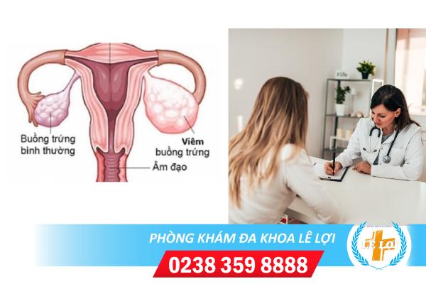Cách Hỗ Trợ Điều Trị Viêm Buồng Trứng An Toàn, Hiệu Quả