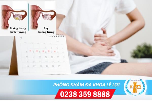 Triệu Chứng Điển Hình Của Bệnh Suy Buồng Trứng Sớm