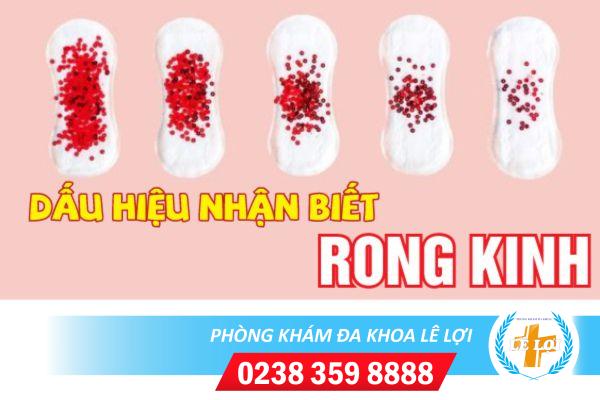 Bệnh Rong Kinh Và Những Điều Nữ Giới Cần Chú Ý