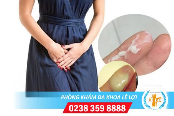 Hỗ Trợ Chữa Khí Hư Bất Thường Ở Nữ Giới Như Thế Nào?