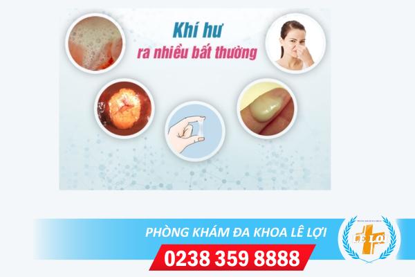 Cách Hỗ Trợ Điều Trị Khí Hư Ra Nhiều Tại Tp. Vinh Dành Cho Phái Đẹp