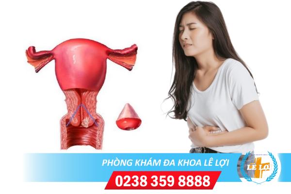 Những Tác Hại Phì Đại Cổ Tử Cung Đối Với Nữ Giới Là Gì?