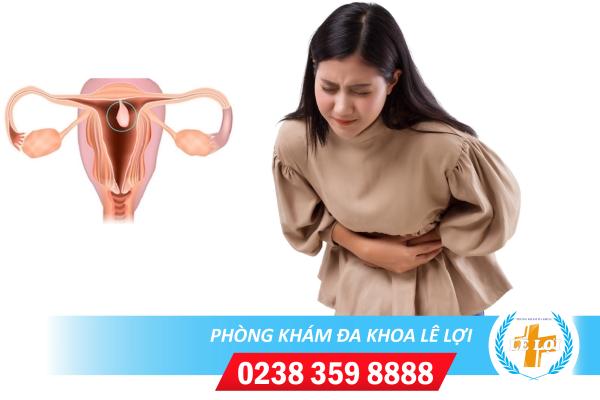 Chi phí chữa trị bệnh polyp cổ tử cung bao nhiêu