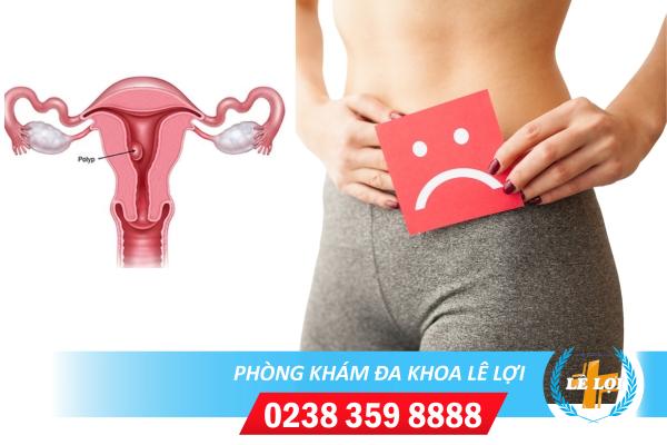 Biểu hiện nhận biết bệnh Polyp tử cung là gì và hỗ trợ điều trị