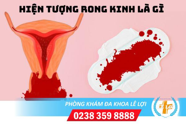 Phương Pháp Hỗ Trợ Cách Chữa Bệnh Rong Kinh Ở Nữ Giới