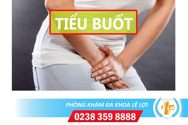 Hiện tượng tiểu buốt.
