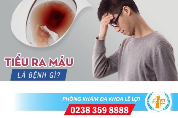 Hãy cảnh giác với triệu chứng đái ra máu.