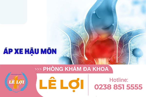 Các Triệu Chứng Bệnh ApXe Hậu Môn Thường Như Thế Nào?