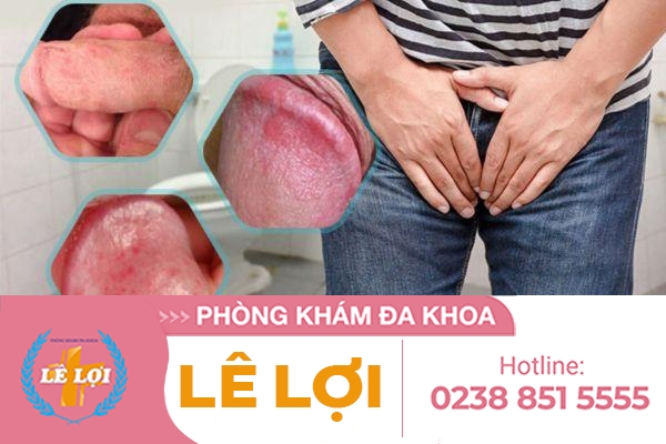 Khám phụ nam khoa tại Phòng khám Đa Khoa Lê Lợi