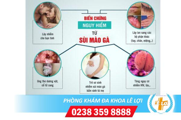Điều trị sùi mào gà hiệu quả không tái phát