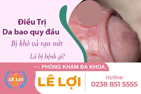 Nứt da quy đầu là dấu hiệu bệnh gì?
