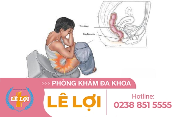 Đau Rát Hậu Môn Là Bệnh Gì ?