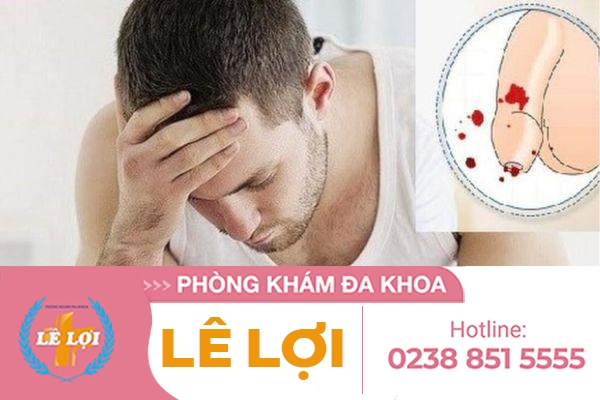 Tại sao dương vật bị chảy máu ?