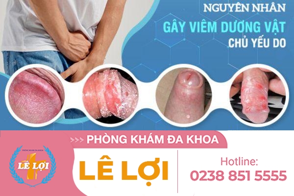 Biểu hiện của bệnh viêm dương vật