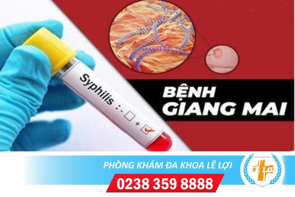 Giang mai có bao nhiêu giai đoạn?