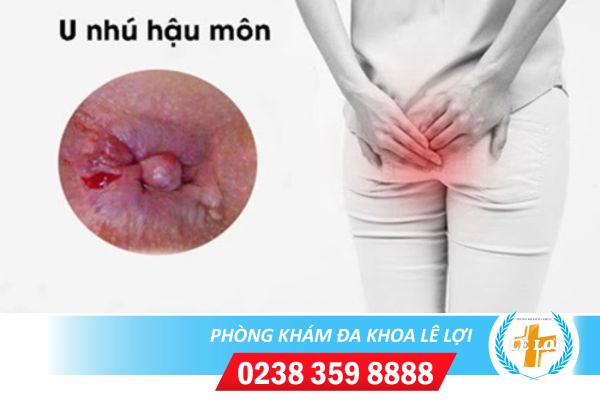 hau-mon-u-nhu