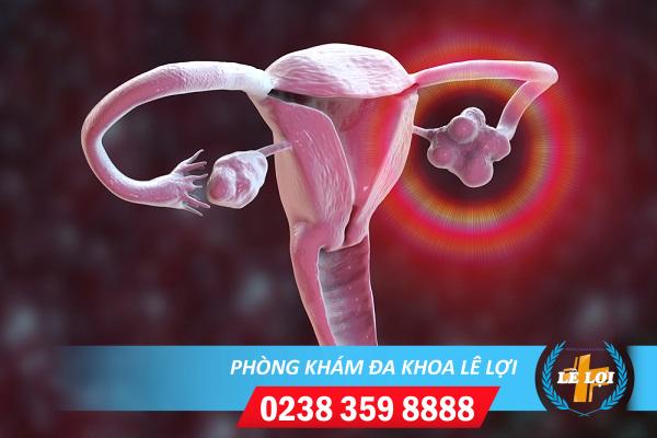Khó rụng trứng là gì?