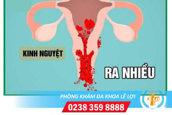 Thủ phạm khiến kinh nguyệt ra nhiều