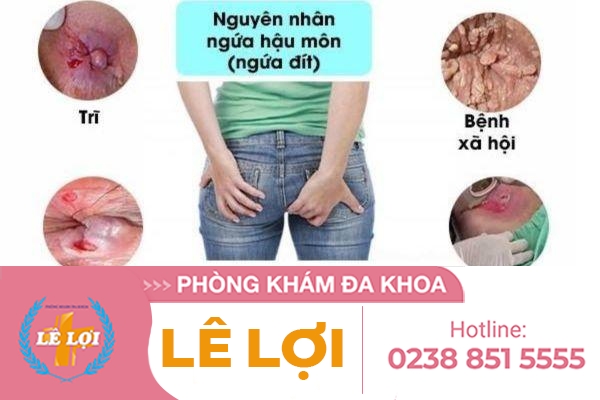 Nguyên nhân nào gây ngứa hậu môn ?