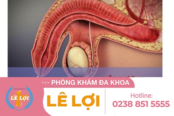 Liệt dương là gì và có chữa được không?