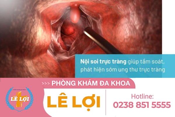 Như Thế Nào Là Nội Soi Trực Tràng ?