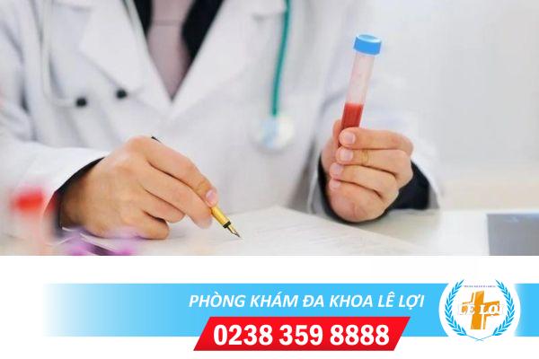 Chi phí kiểm tra nội tiết tố là bao nhiêu?
