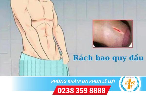 Nguyên nhân rách bao quy đầu sau khi quan hệ