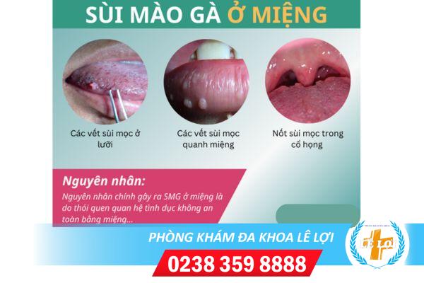 sui-mao-ga-o-mieng