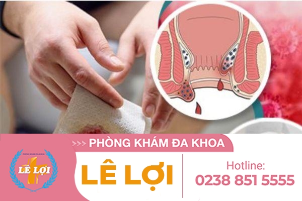 Đi cầu ra máu là bệnh gì ?