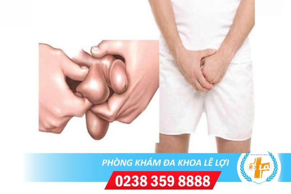 Tại sao lại ngứa tinh hoàn ?