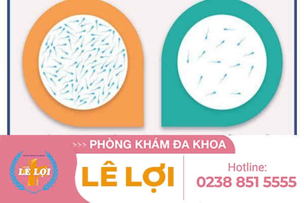 Tình trạng tinh trùng ít có chữa được không ?