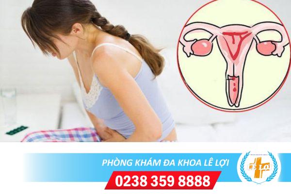 Tử cung bất thường ảnh hưởng đến khả năng sinh sản