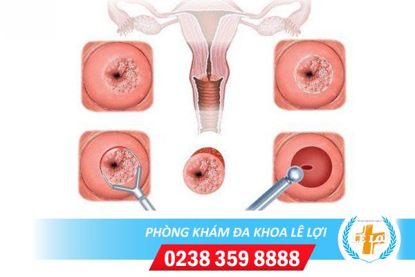 Kiểm tra tử cung ở đâu an toàn, hiệu quả?