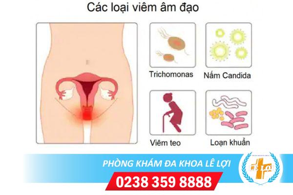 Biểu hiện của bệnh viêm âm đạo là như thế nào?