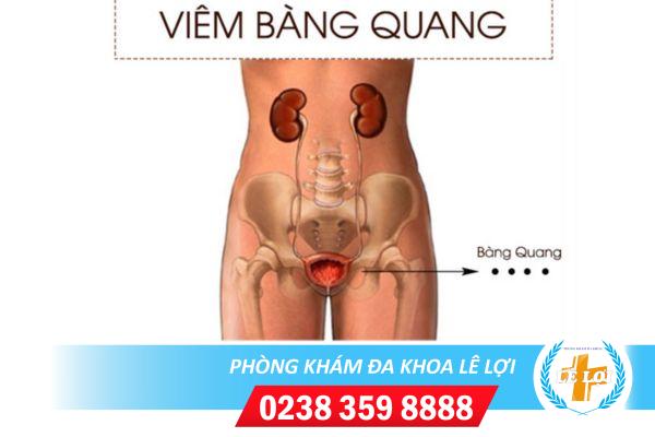 Những điều có thể bạn chưa biết về bệnh viêm bàng quang