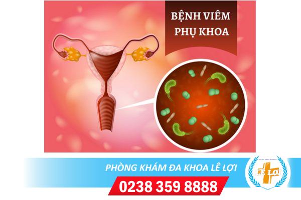 Dấu hiệu bệnh viêm nhiễm phụ khoa