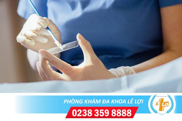Xét nghiệm phụ khoa ở đâu uy tín?