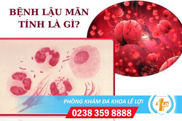 Bệnh lậu mãn tính và phương pháp hỗ trợ điều trị