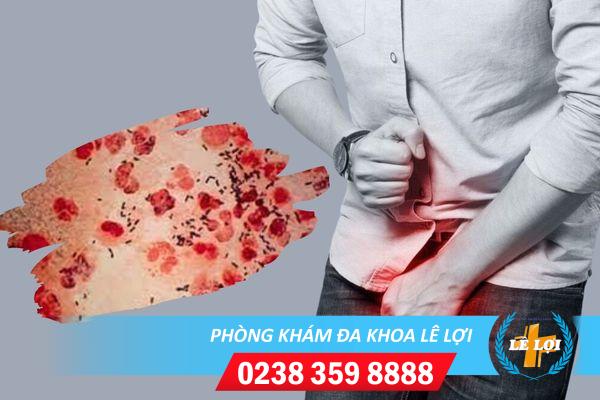 Biểu hiện của bệnh lậu ra sao?