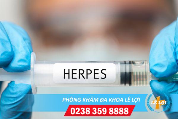 Herpes sinh dục là gì ?