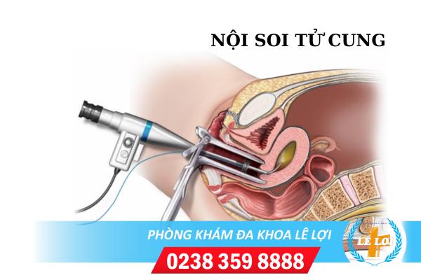 Nội soi tử cung là gì? Tại sao cần nội soi tử cung?