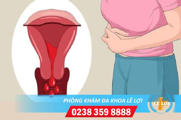 Những bệnh lý nguy hiểm gây xuất huyết âm đạo