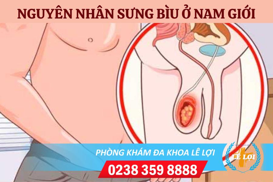 Phát hiện bìu sưng to – Đây là đều cần nên làm