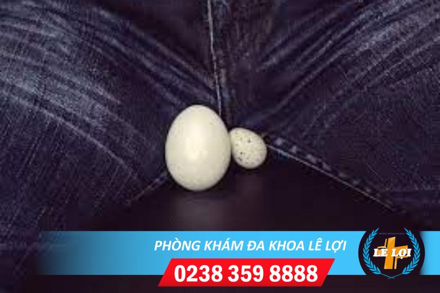 Tinh hoàn bên to bên nhỏ là bị bệnh gì?