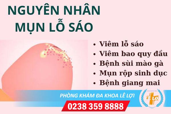 Nguyên nhân nổi mụn ở lỗ sáo và cách điều trị hiệu quả