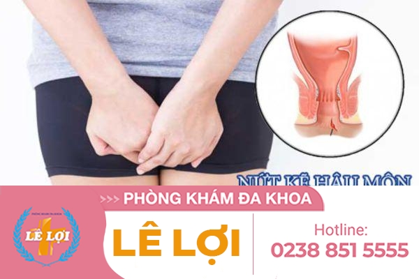 Biểu hiện của nứt kẽ hậu môn và cách điều trị hiệu quả