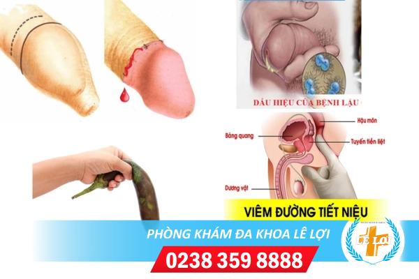 bao-quy-dau-chay-mau-do-nhieu-nguyen-nhan