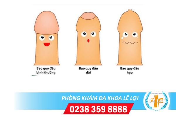 Các bệnh lý ở bao quy đầu không nên bỏ qua